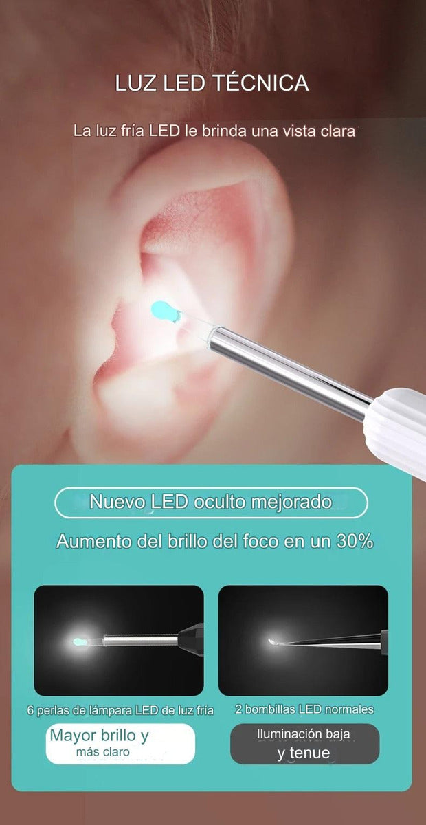 SaludAuditiva Limpiador Oídos Endoscopio Cámara HD Inalámbrica Recargable – Experiencia de Limpieza Auditiva Excepcional