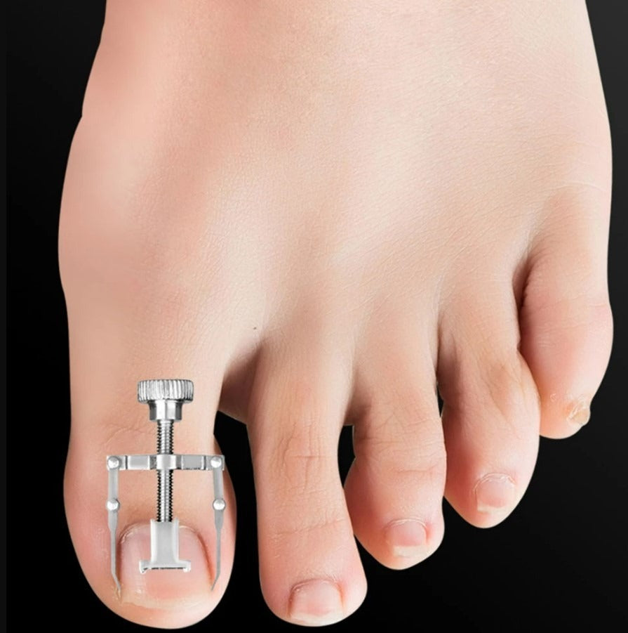 Herramientas Uñas Encarnadas – Solución Completa Para Pedicura